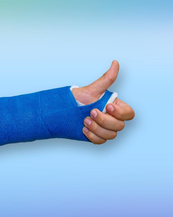Arm in blue cast.