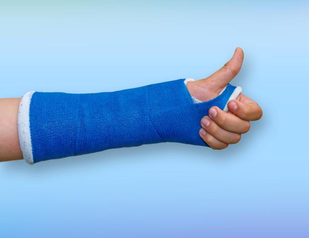 Arm in blue cast.